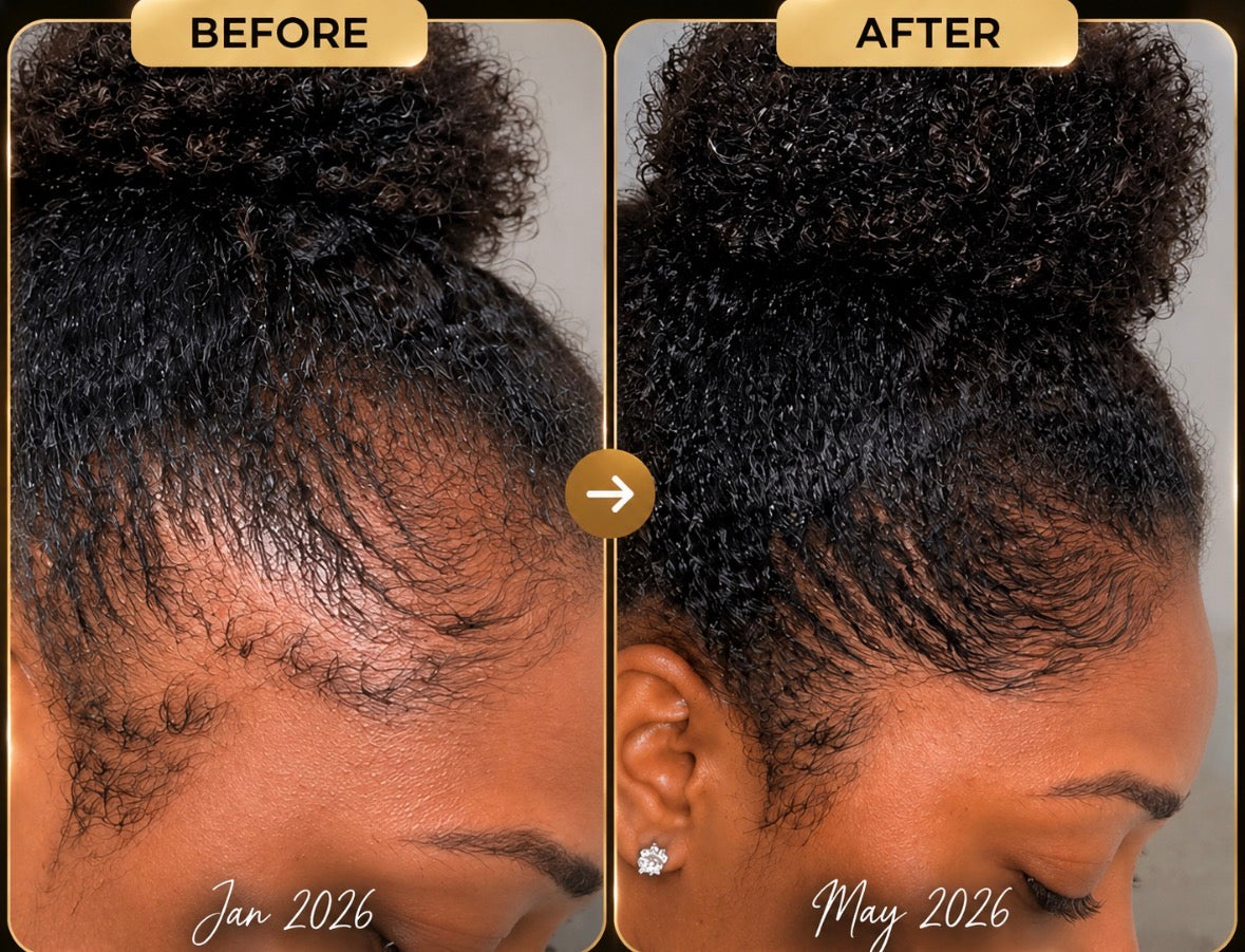 Hair Growth Bundle | 2-Step Moisture Routine