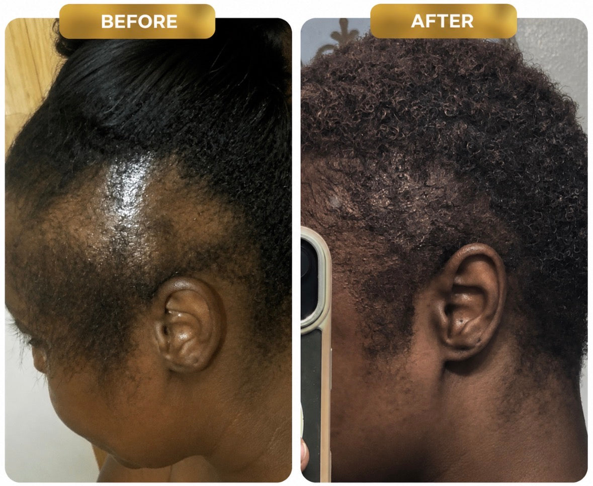 Hair Growth Bundle | 2-Step Moisture Routine